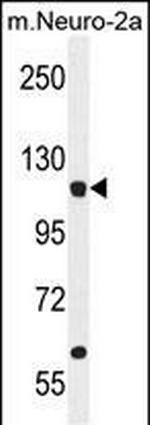 LARS Polyclonal Antibody