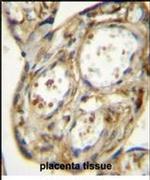 DLK1 Antibody in Immunohistochemistry (IHC)