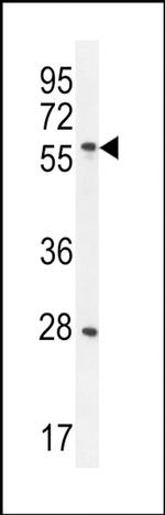 DLK1 Antibody in Western Blot (WB)