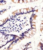 CYP11B2 Antibody in Immunohistochemistry (IHC)