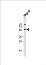 CYP11B2 Antibody in Western Blot (WB)
