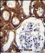 GPX3 Antibody in Immunohistochemistry (IHC)