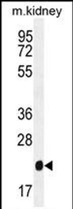 GPX3 Antibody in Western Blot (WB)
