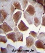 EIF2B4 Polyclonal Antibody