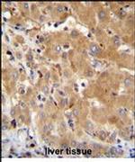 GGH Antibody in Immunohistochemistry (IHC)