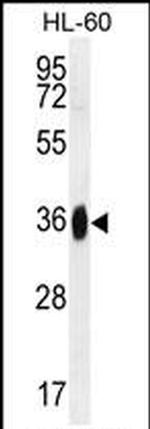 GGH Antibody in Western Blot (WB)