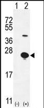 Epigen Antibody in Western Blot (WB)