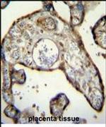 Myeloid Specific Antigen Antibody in Immunohistochemistry (IHC)