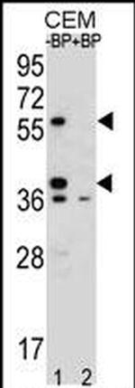 Myeloid Specific Antigen Antibody in Western Blot (WB)