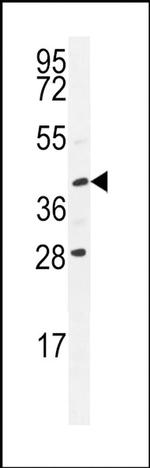 USP50 Antibody in Western Blot (WB)
