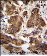 ZGRF1 Antibody in Immunohistochemistry (IHC)