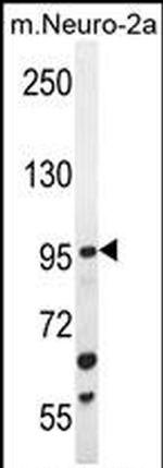 ZGRF1 Antibody in Western Blot (WB)