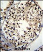 ALKBH6 Antibody in Immunohistochemistry (IHC)