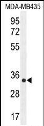 ALKBH6 Antibody in Western Blot (WB)