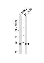 PLD6 Polyclonal Antibody