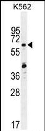 ZNF619 Antibody in Western Blot (WB)
