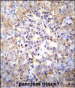TSNARE1 Polyclonal Antibody