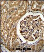 MOGAT1 Antibody in Immunohistochemistry (IHC)