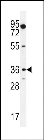 MOGAT1 Antibody in Western Blot (WB)