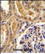 TLL2 Antibody in Immunohistochemistry (IHC)