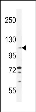 TLL2 Antibody in Western Blot (WB)