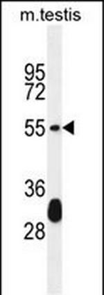 Krt33a Polyclonal Antibody
