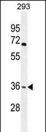 OR4F15 Polyclonal Antibody