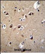 LRTM2 Antibody in Immunohistochemistry (IHC)
