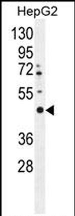 LRTM2 Antibody in Western Blot (WB)