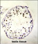 DNAAF3 Polyclonal Antibody