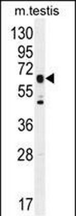 DNAAF3 Antibody in Western Blot (WB)