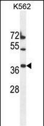 TMEM150B Antibody in Western Blot (WB)