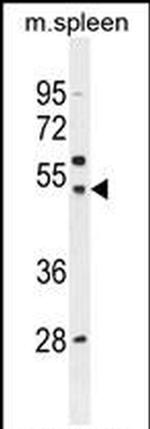 SLC16A13 Antibody in Western Blot (WB)