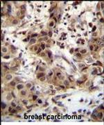 ZNF321P Antibody in Immunohistochemistry (IHC)