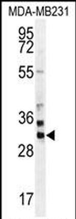 ZNF321P Antibody in Western Blot (WB)