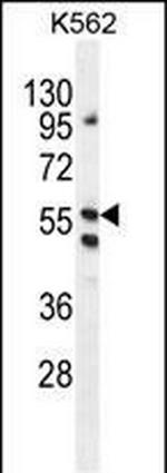 LRIT1 Polyclonal Antibody
