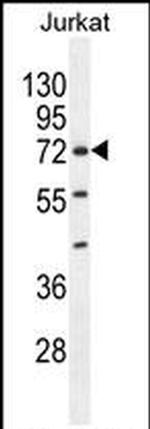 ZNF648 Antibody in Western Blot (WB)