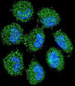 PRAMEF6 Polyclonal Antibody