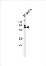 ZSCAN5B Antibody in Western Blot (WB)
