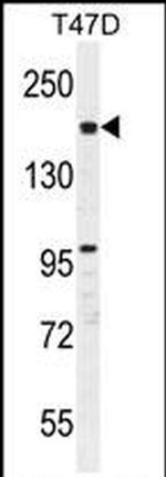 FHAD1 Antibody in Western Blot (WB)