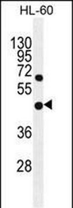 GDPD1 Antibody in Western Blot (WB)