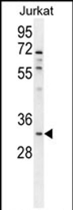 OR5B12 Antibody in Western Blot (WB)