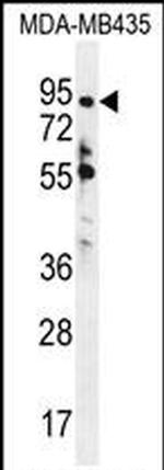 ZNF605 Antibody in Western Blot (WB)