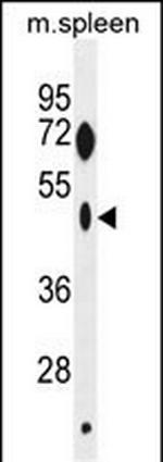 ZNF385C Polyclonal Antibody