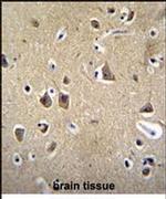 FADS6 Antibody in Immunohistochemistry (IHC)