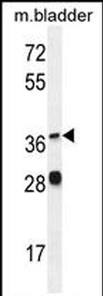 FADS6 Antibody in Western Blot (WB)