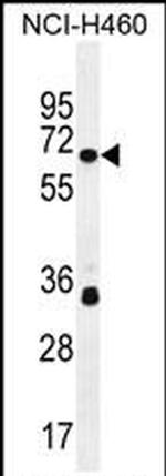 ZNF433 Antibody in Western Blot (WB)