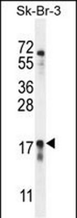 C1orf115 Polyclonal Antibody