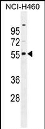 RASSF8 Antibody in Western Blot (WB)