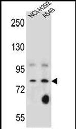 SCEL Antibody in Western Blot (WB)